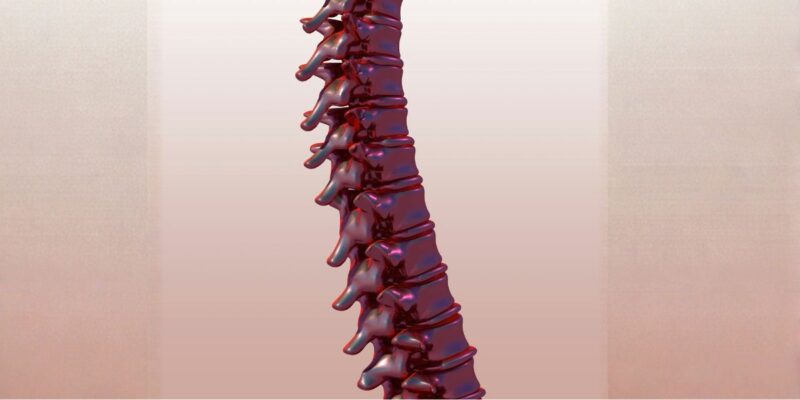 Just Diagnosed With a Herniated Disc? What the First Six Weeks Can Look Like, and What a New Study Says About Healing
