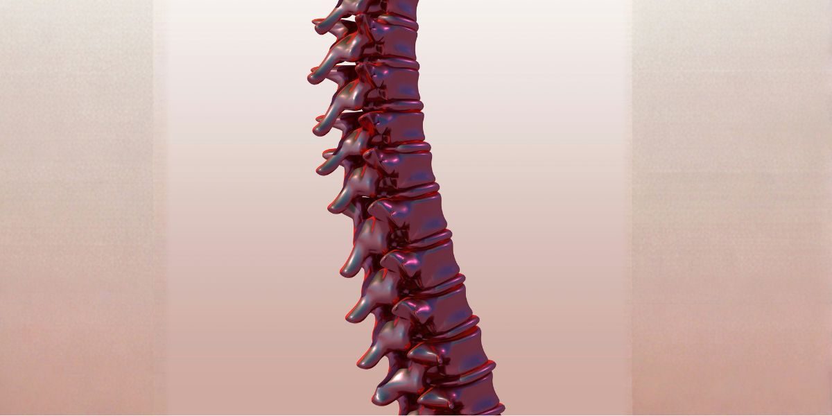 Just Diagnosed With a Herniated Disc? What the First Six Weeks Can Look Like, and What a New Study Says About Healing